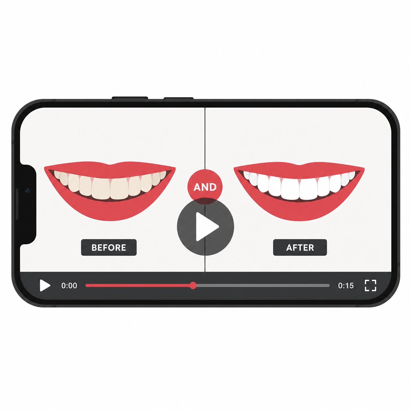 Phone screen showing a before-and-after smile makeover video with a play button